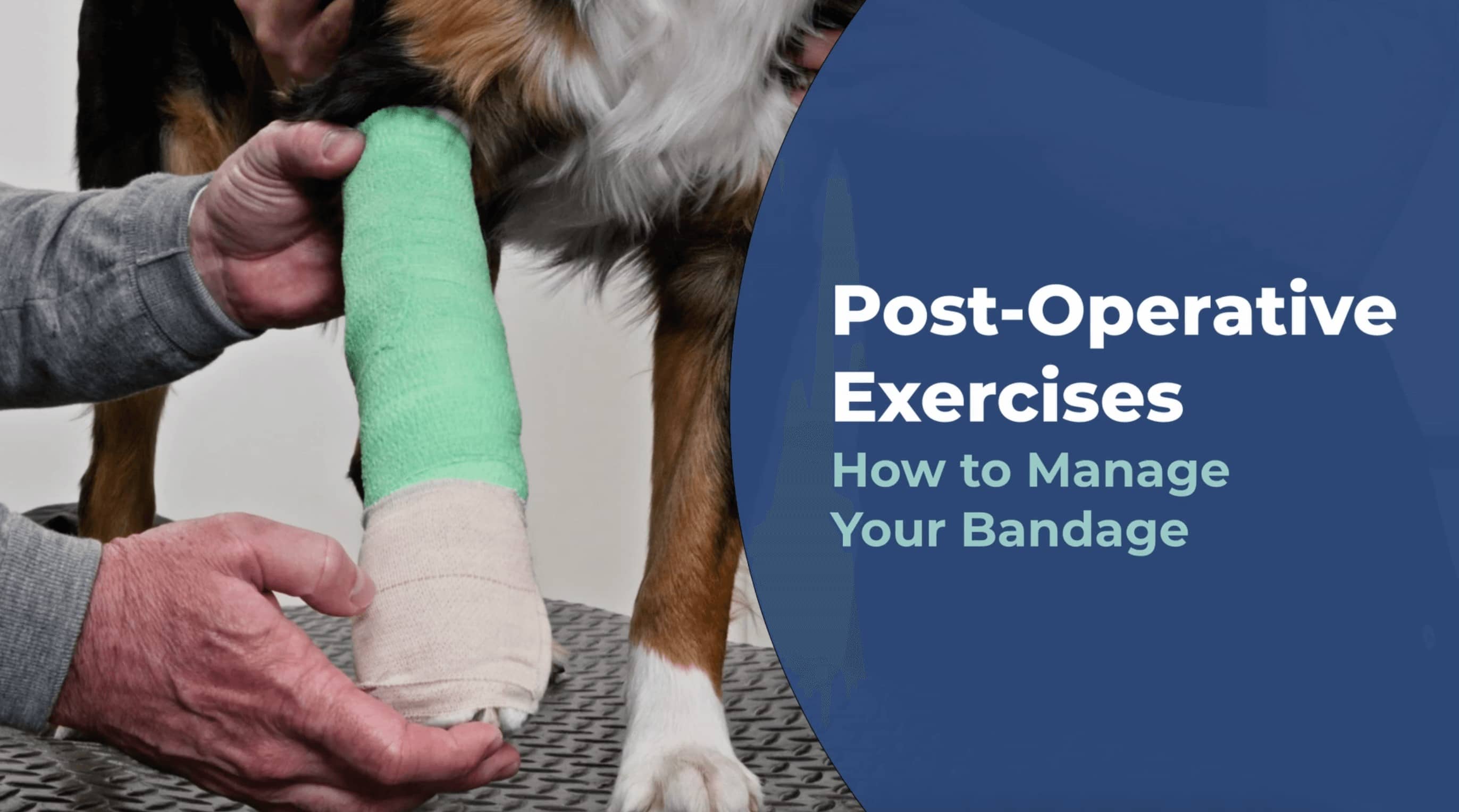 How to manage your bandage video